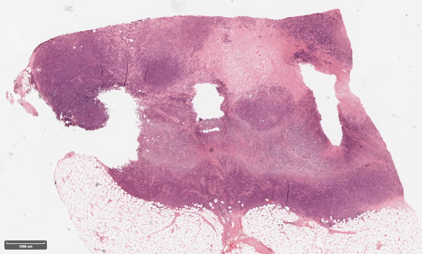 Original whole-slide image from TCGA-HN-A2NL-01Z