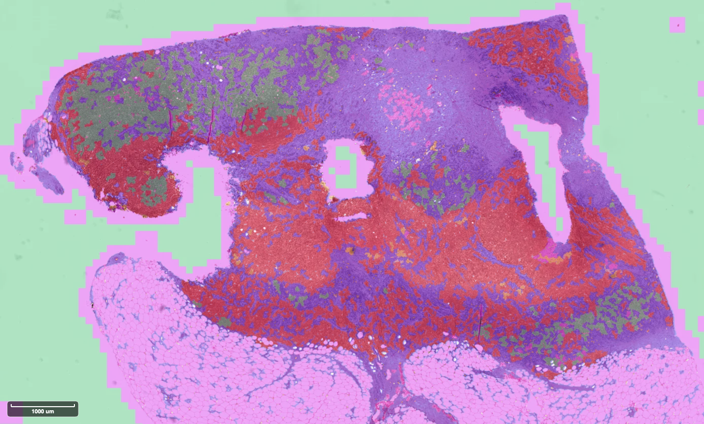 Segmentation overlay generated using fcn_resnet50_unet-bcss